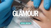 Extreme Glamour Tries: Botox Reviewed On Video