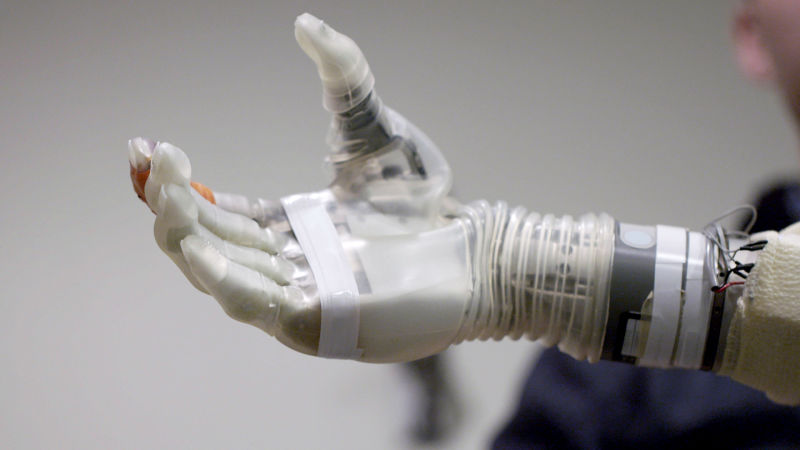 Watch A Robotic Arm Controlled By The Mind The New Yorker Video Cne
