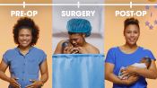 This is Your C-Section in 2 Minutes