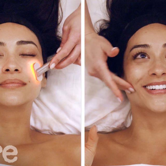 allure glp 1 I Got Skin Removal Surgery After Losing 230 Pounds On a GLP-1