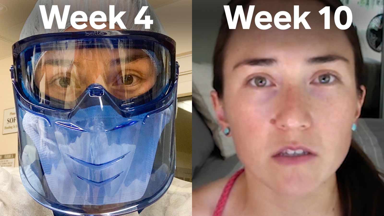 Diary of a Trauma Surgeon: 10 Weeks of Covid-19