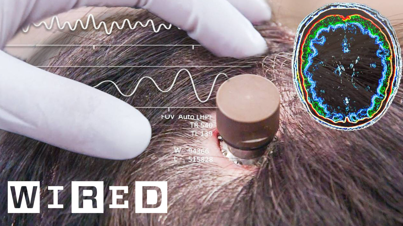 イーロン・マスクのNeuralink開発、脳に埋め込むチップが秘めた可能性 | Currents