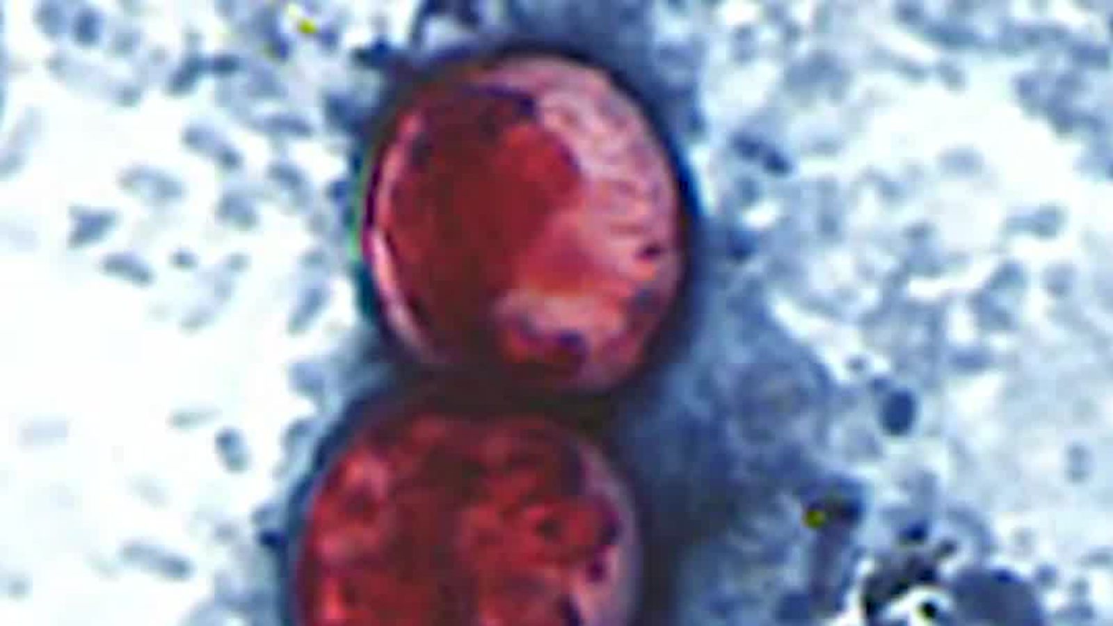 The US’s Explosive Diarrhea Problem Is Worse Than You Think—And It’s About to Get Even Messier