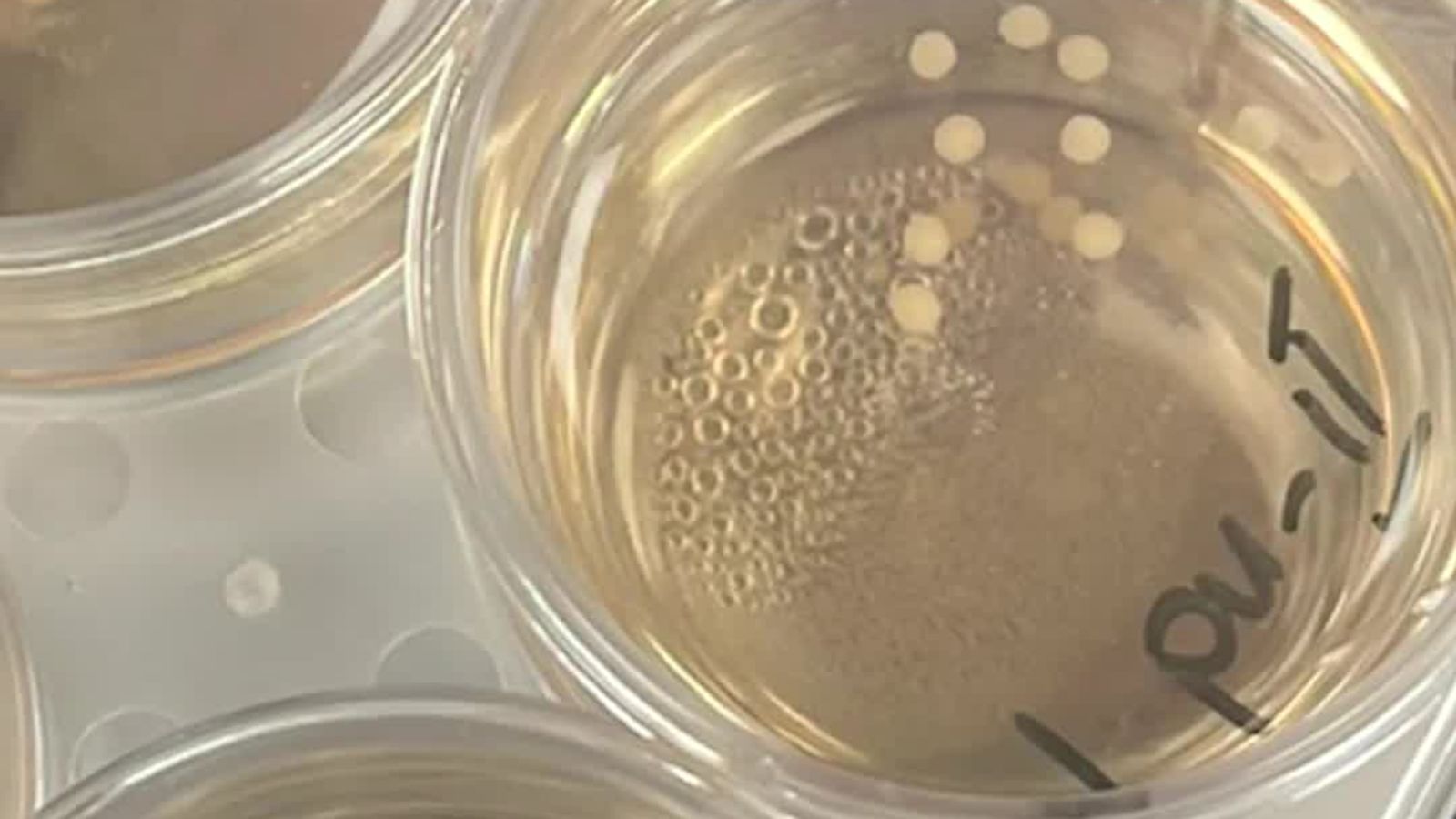 Mini Human Brains Are Being Grown in Labs All Over the World