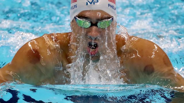 Cupping, the Olympics' Hottest Trend