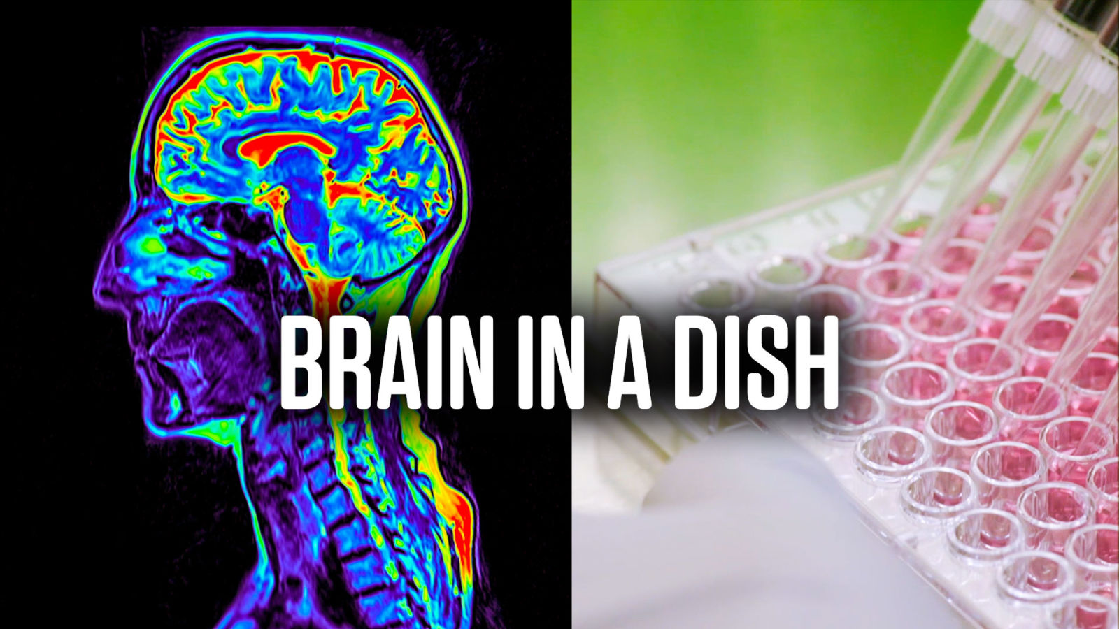 How Brain Organoids Help Scientists Battle Disease | WIRED Brand Lab