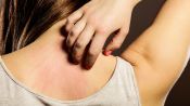 Why You Might Be Itchy All Over Even Though You Don’t Have a Rash