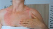 9 Questions That Will Help You Decode That Rash
