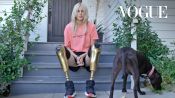 La inspiradora historia de Lauren Wasser, la modelo de las piernas doradas