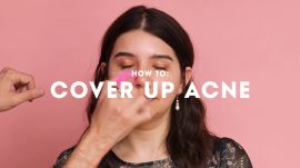 2018 Acne Awards: How to Cover Up Acne