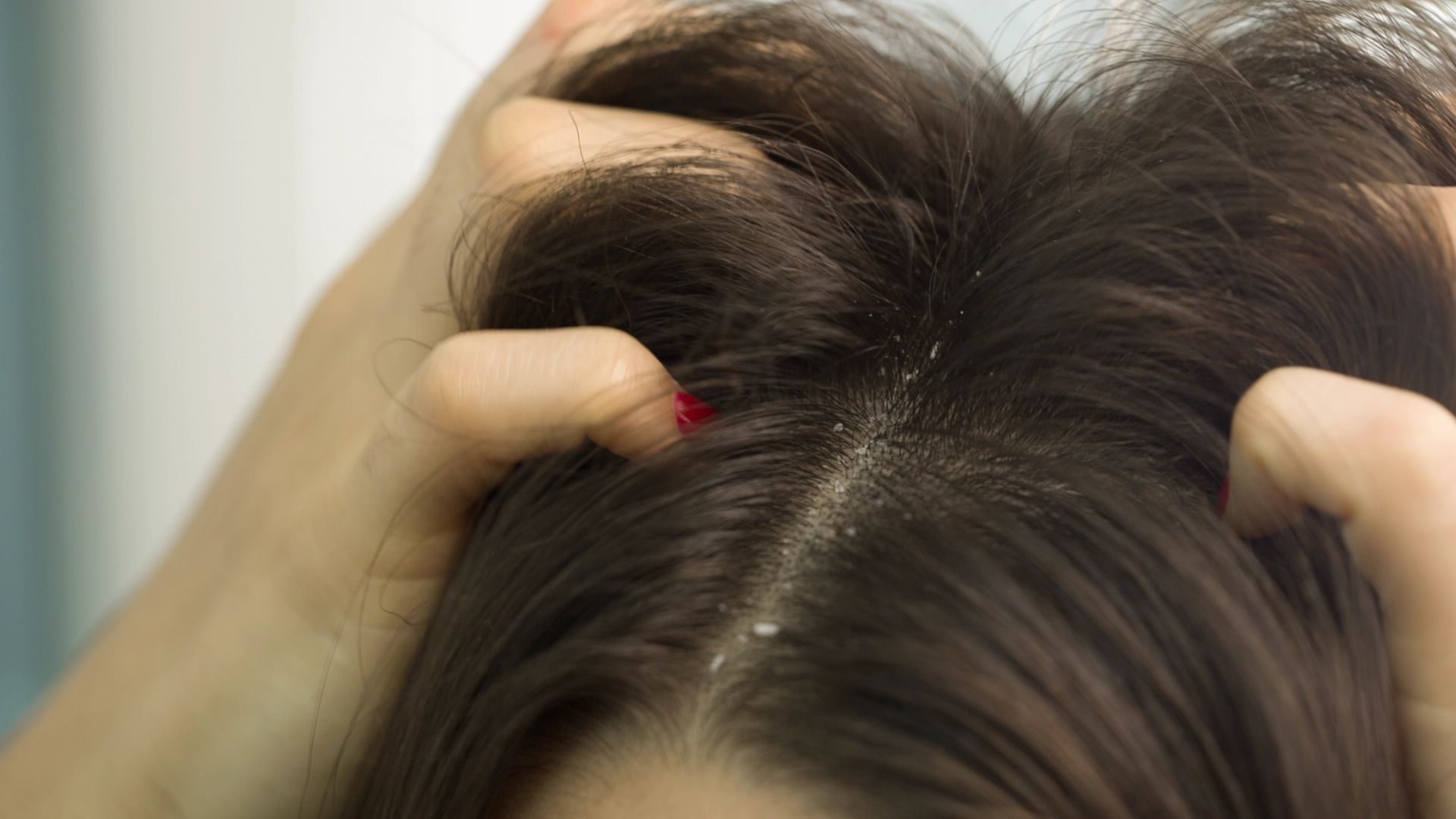 Watch 6 Common Dandruff Myths | SELF Video | CNE | Self.com | SELF