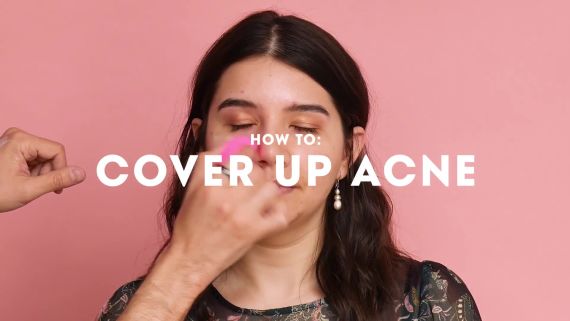 2018 Acne Awards How To Cover Up Acne 2018 Acne Awards How To Cover Up Acne