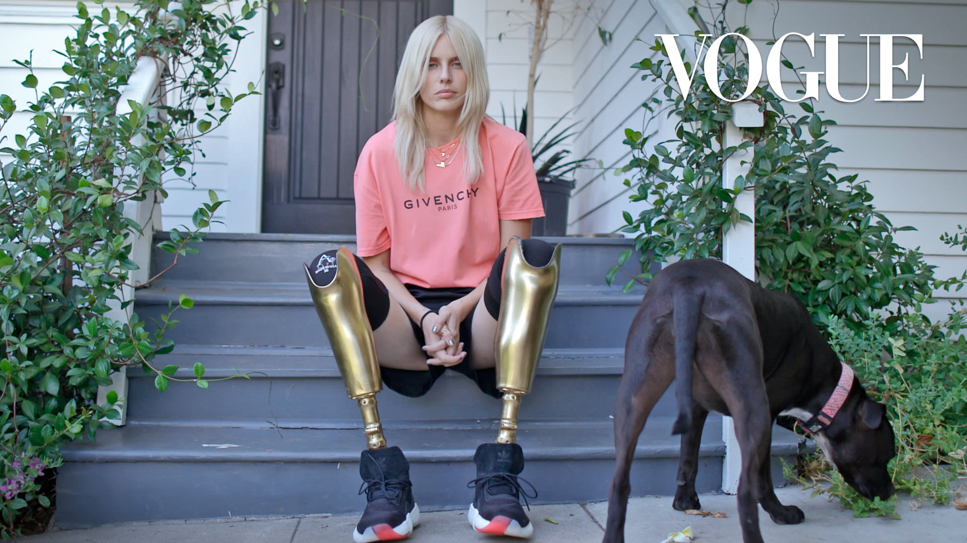 Ver La inspiradora historia de Lauren Wasser, la modelo de las piernas  doradas | Vogue
