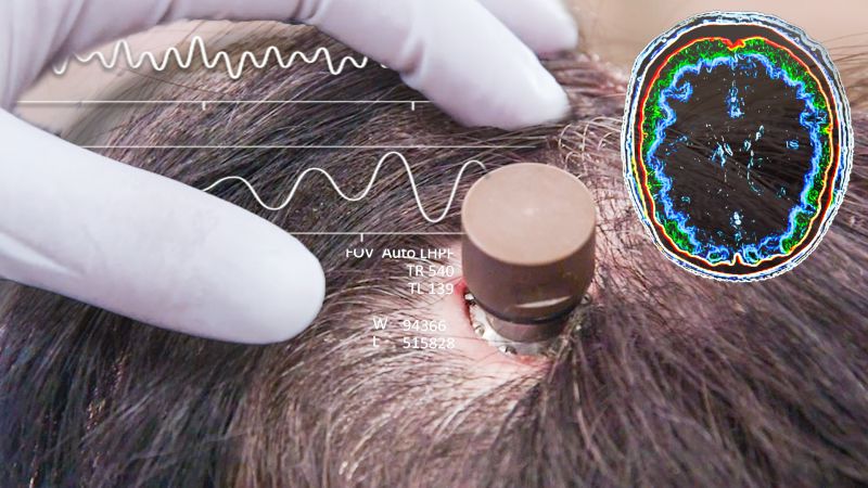 Watch The Science Behind Elon Musk's Neuralink Brain Chip | Currents | WIRED