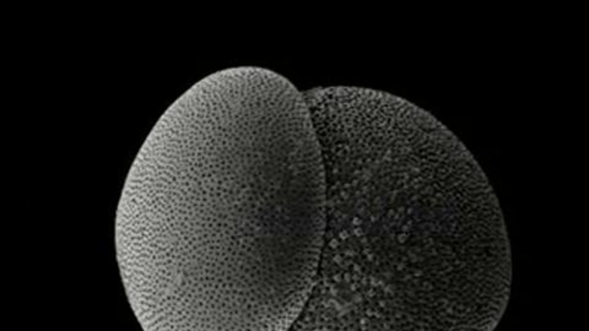 Watch Turbotalia, il microfossile a forma di pop-corn